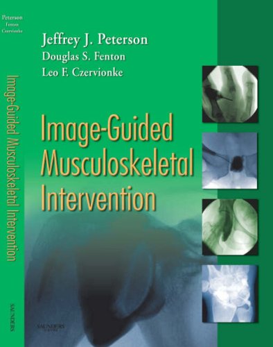 ImageGuided Musculoskeletal Intervention,Used