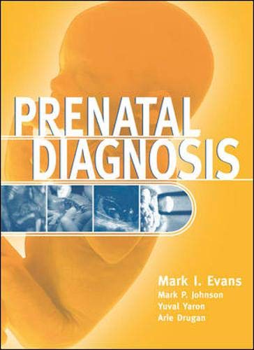 Prenatal Diagnosis,Used