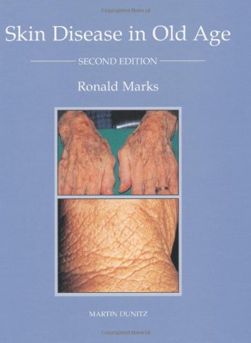 Skin Disease In Old Age, Second Edition,Used