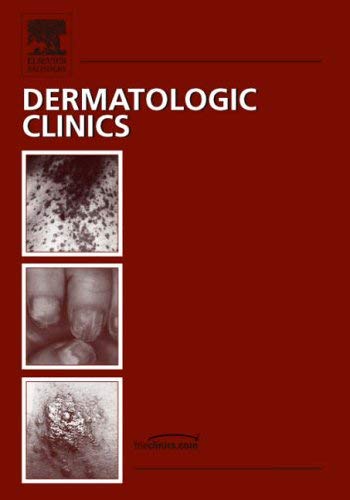 Women's Dermatology, An Issue of Dermatologic Clinics (Volume 242) (The Clinics: Dermatology, Volume 242),Used