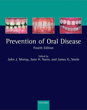 Prevention of Oral Disease,Used