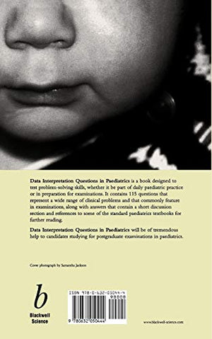 Data Interpretation Questions in Paediatrics,Used