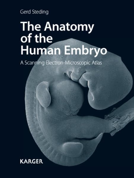 The Anatomy of the Human Embryo: A Scanning ElectronMicroscopic Atlas,Used