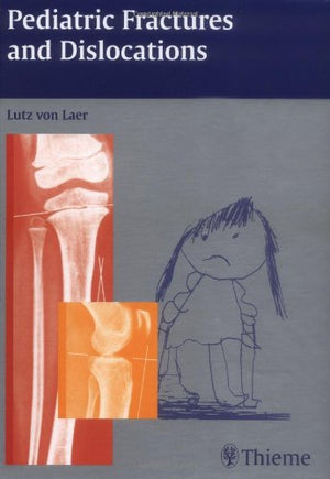 Pediatric Fractures and Dislocations,Used