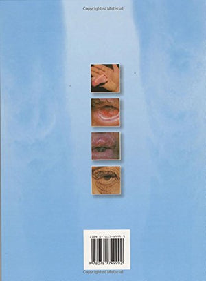 Diseases of the Eye and Skin: A Color Atlas,Used