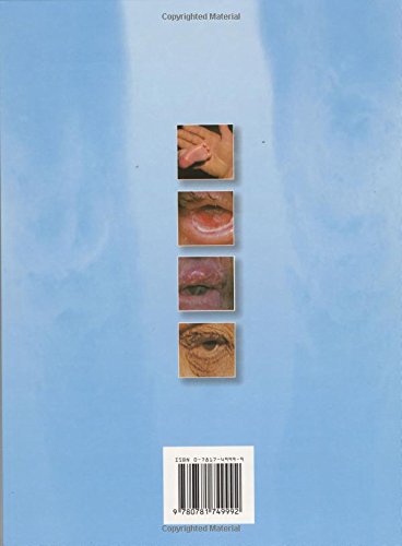 Diseases of the Eye and Skin: A Color Atlas,Used