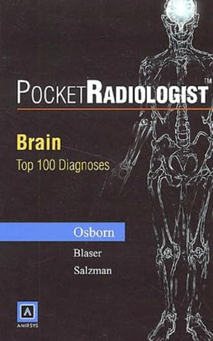 Pocketradiologist: Brain Top 100 Diagnoses,New