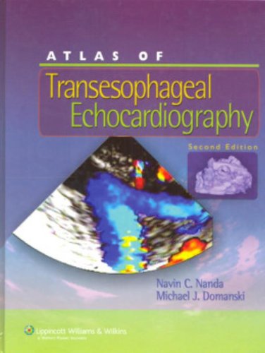 Atlas of Transesophageal Echocardiography,Used