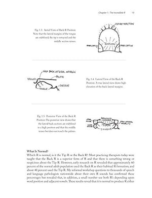 Successful R Therapy: Fixing The Hardest Sound In The World,Used
