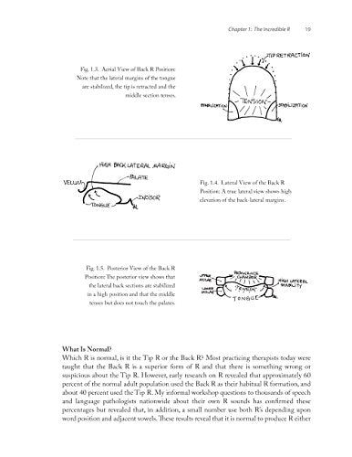 Successful R Therapy: Fixing The Hardest Sound In The World,Used