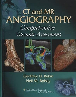 CT and MR Angiography: Comprehensive Vascular Assessment,Used