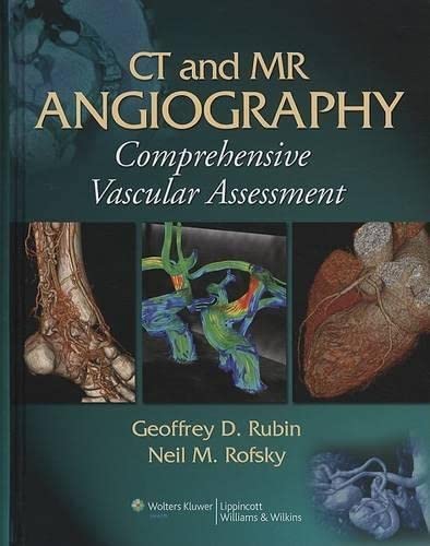 CT and MR Angiography: Comprehensive Vascular Assessment,Used