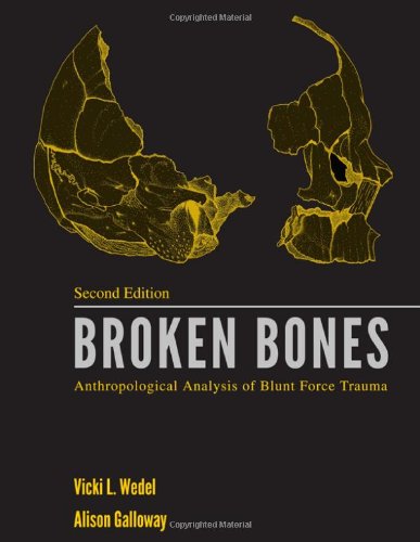 Broken Bones: Anthropological Analysis of Blunt Force Trauma,Used