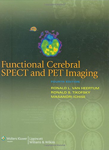 Functional Cerebral SPECT and PET Imaging,Used