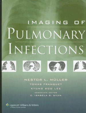 Imaging of Pulmonary Infections,Used