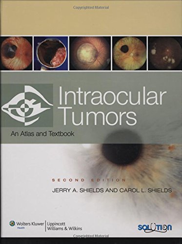 Intraocular Tumors: An Atlas and Text,Used