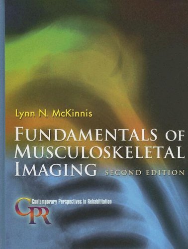 Fundamentals of Musculoskeletal Imaging (Contemporary Perspectives in Rehabilitation),New