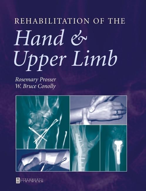 Rehabilitation of the Hand and Upper Limb,Used
