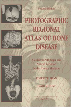 Photographic Regional Atlas of Bone Disease: A Guide to Pathologic and Normal Variation in the Human Skeleton,Used