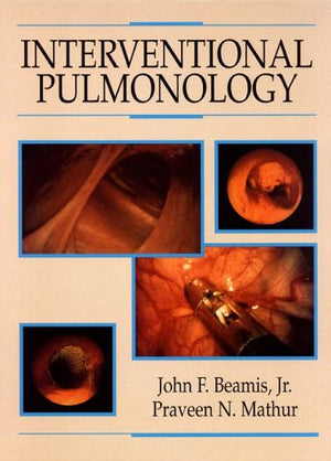 Interventional Pulmonology,Used