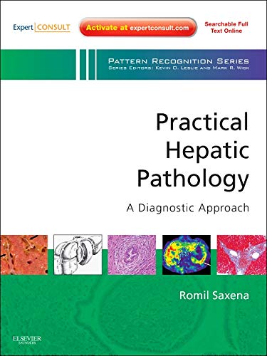 Practical Hepatic Pathology: A Diagnostic Approach: A Volume in the Pattern Recognition Series, Expert Consult: Online and Print
