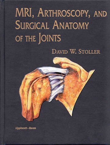 Mri, Arthroscopy, and Surgical Anatomy of the Joints,Used