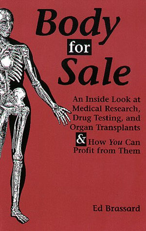 Body For Sale