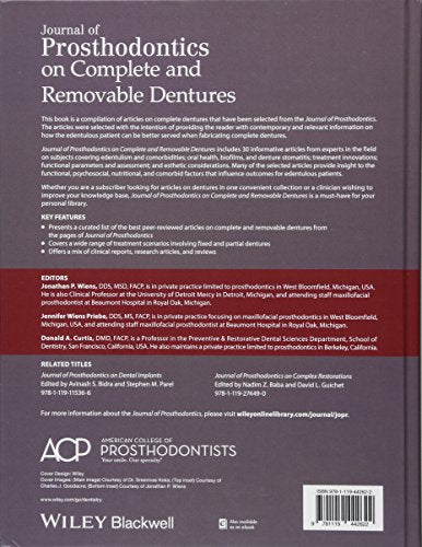 Journal of Prosthodontics on Complete and Removable Dentures,Used