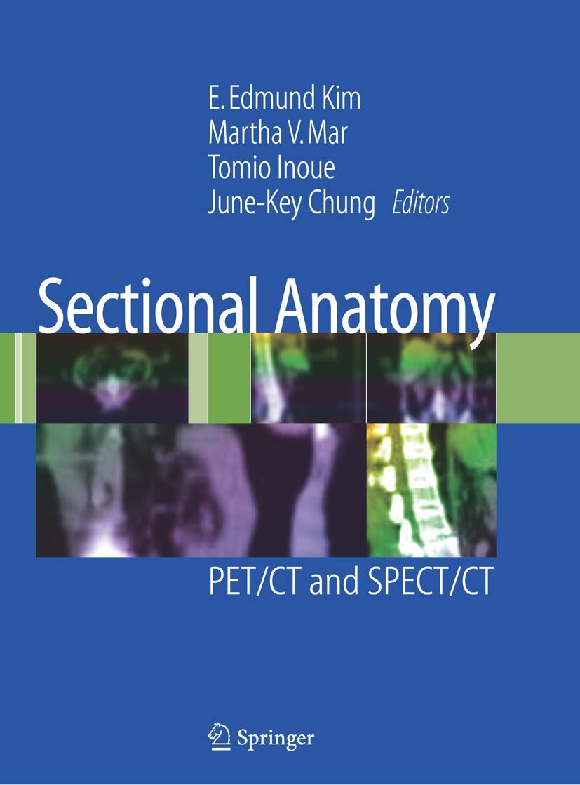 Sectional Anatomy: PET/CT and SPECT/CT,Used