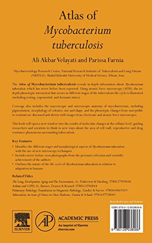 Atlas of Mycobacterium Tuberculosis,Used