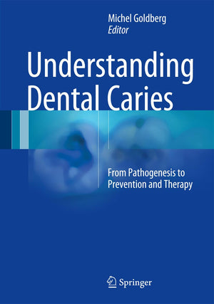 Understanding Dental Caries: From Pathogenesis to Prevention and Therapy,Used