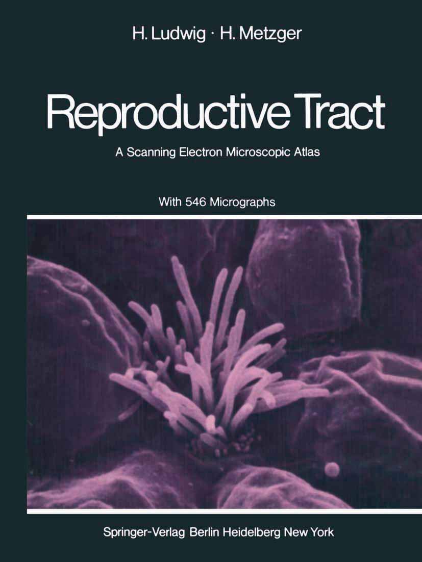 The Human Female Reproductive Tract: A Scanning Electron Microscopic Atlas,Used