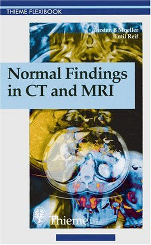 Normal Findings in Ct and Mri (Thieme Flexibook),Used