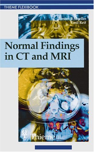 Normal Findings in Ct and Mri (Thieme Flexibook),Used