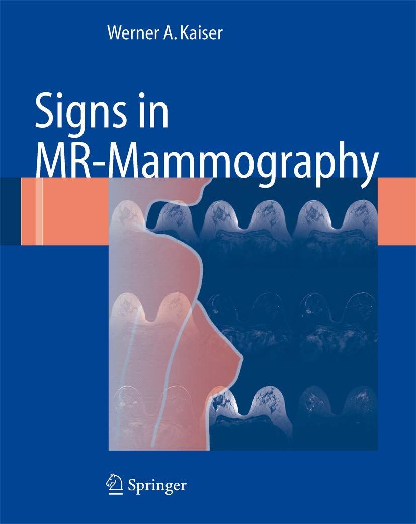 Signs in MRMammography,Used