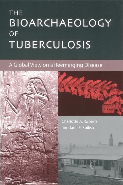 The Bioarchaeology Of Tuberculosis: A Global View On A Reemerging Disease,Used