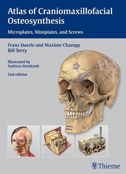 Atlas of Craniomaxillofacial Osteosynthesis: Microplates, Miniplates,and Screws,New
