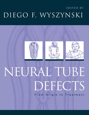 Neural Tube Defects: From Origin to Treatment,Used