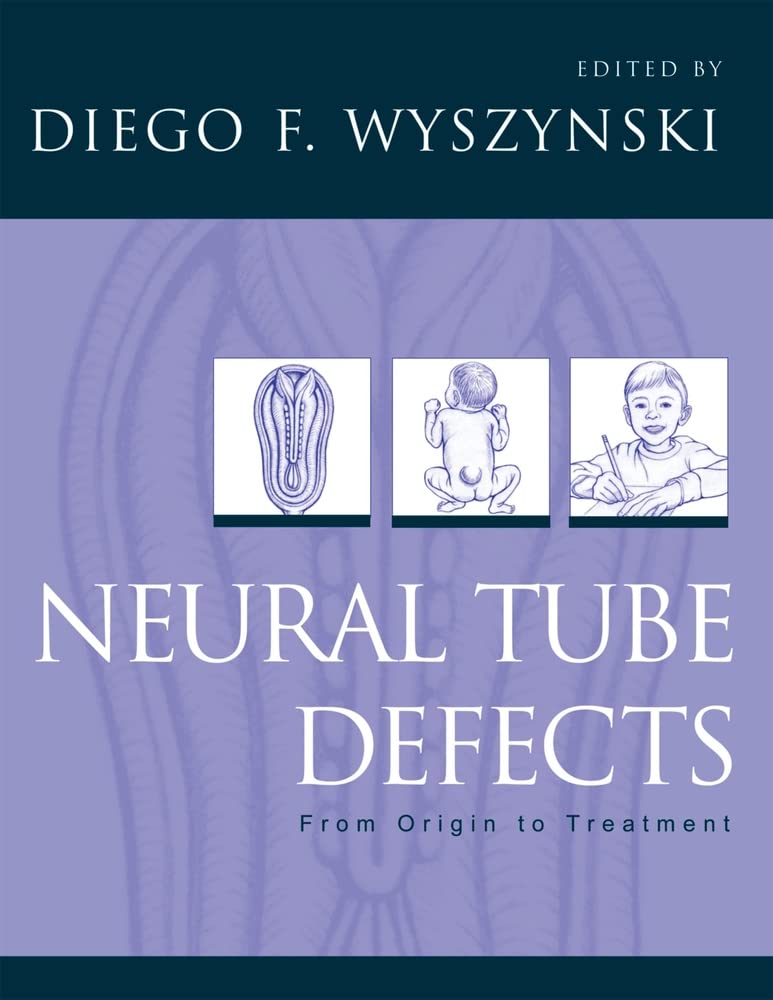 Neural Tube Defects: From Origin to Treatment,Used