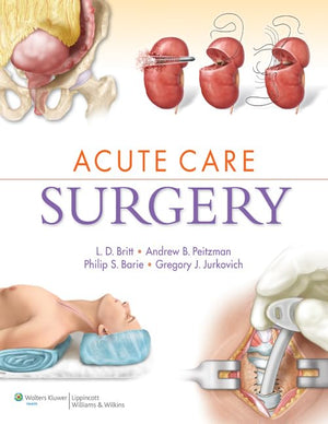 Acute Care Surgery,Used
