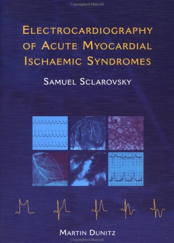 Electrocardiography of Acute Myocardial Ischemia and Infarction,Used