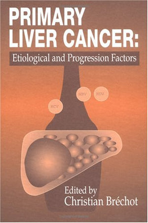 Primary Liver Canceretiological And Progression Factors,Used
