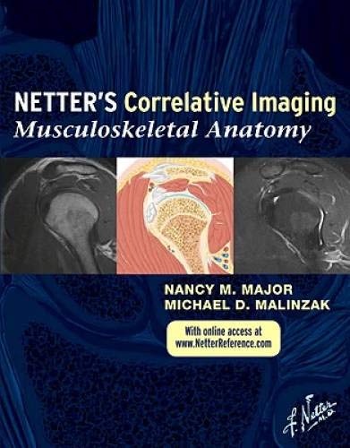 Netter's Correlative Imaging: Musculoskeletal Anatomy,Used