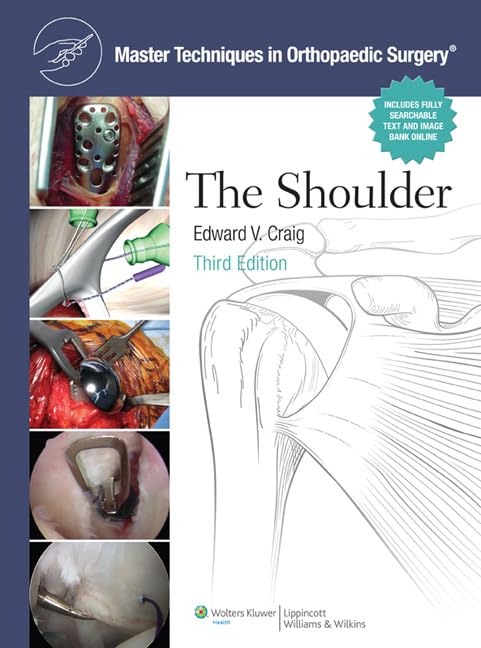 Master Techniques in Orthopaedic Surgery: Shoulder,Used