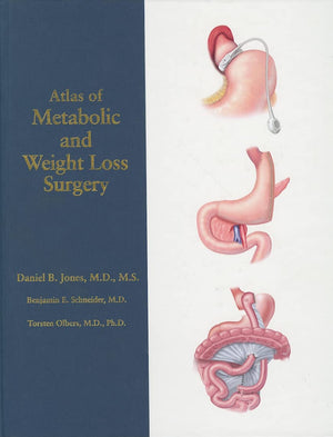 Atlas of Metabolic and Weight Loss Surgery,Used