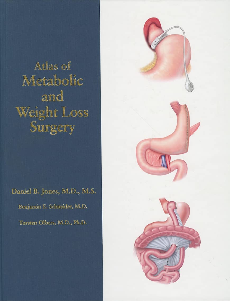 Atlas of Metabolic and Weight Loss Surgery,Used