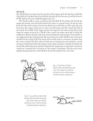 Successful R Therapy: Fixing The Hardest Sound In The World,Used