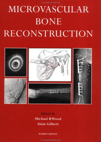 Microvascular Bone Reconstruction,Used