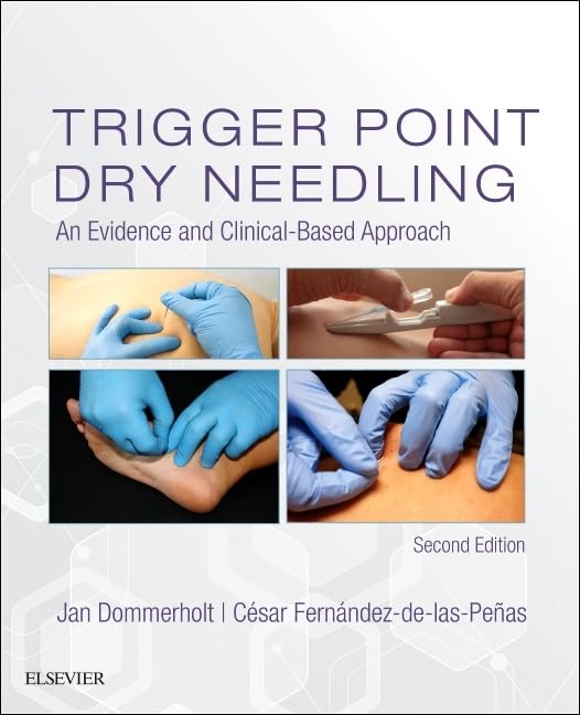 Trigger Point Dry Needling: An Evidence And Clinicalbased Approach