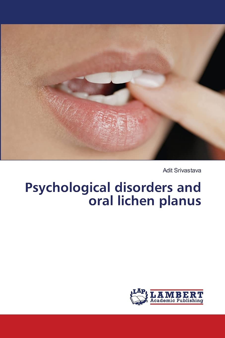 Psychological disorders and oral lichen planus,Used